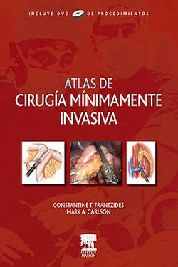 Atlas de Cirugía Minimamente Invasiva