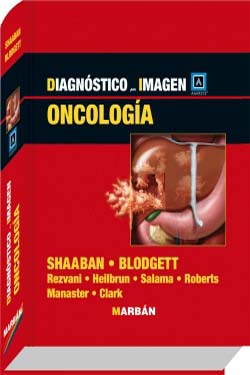 Diagnóstico por imagen Oncología