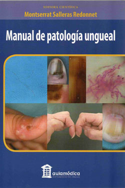 Manual de Patología Ungueal