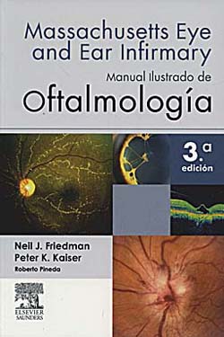 MASSACHUSET Manual Ilustrado de Oftalmología