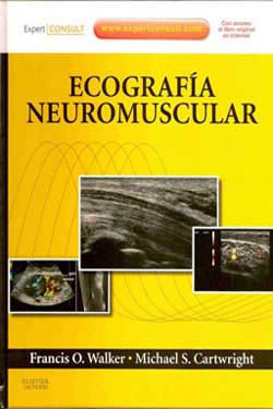 Ecografía Neuromuscular