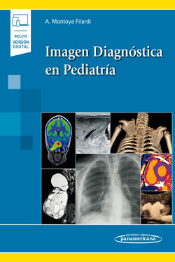 Imagen Diagnóstica en Pediatría + Ebook