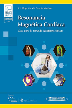 Resonancia Magnética Cardíaca + Ebook