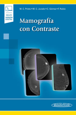 Mamograf�a con Contraste + Ebook
