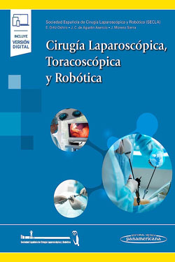 Cirugía Laparoscópica Toracoscópica y Robótica