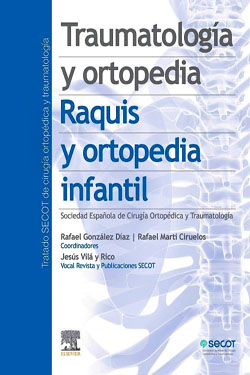Traumatología y Ortopedia. Raquis y Ortopedia Infantil SECOT Tomo 4