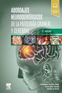Abordajes Neuroquirúrgicos de la Patología Craneal y Cerebral