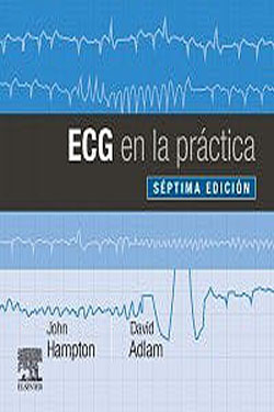 ECG en la Práctica