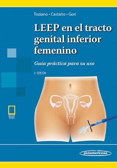 LEEP en el Tracto Genital Inferior Femenino + Ebook