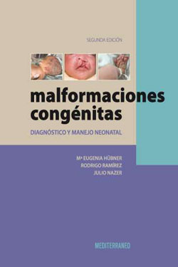Malformaciones Congénitas