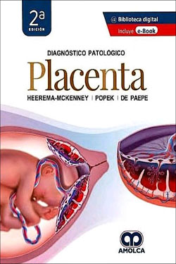 Diagnóstico Patológico Placenta