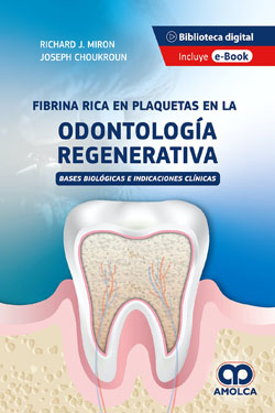 Fibrina Rica en Plaquetas en la Odontología Regenerativa