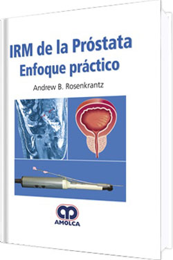 IRM de la Próstata Enfoque Práctico
