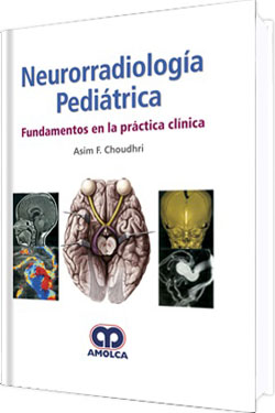 Neurorradiología Pediátrica
