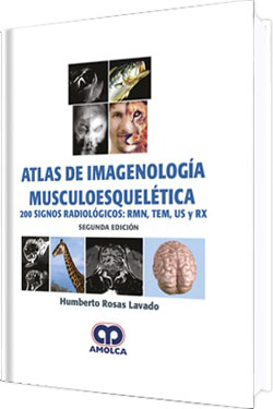 Atlas de Imagenología Musculoesquelética