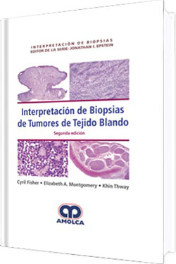 Interpretación de Biopsias de Tumores del Tejido Blando