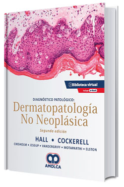Dermatopatología No Neoplásica