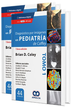 Diagnóstico por Imágenes en Pediatría de Caffey 2 Ts