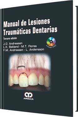 Manual de Lesiones Dentarias Traumáticas