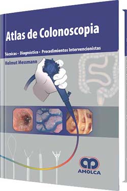 Atlas de Colonoscopia