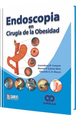 Endoscopia en Cirugía de la Obesidad