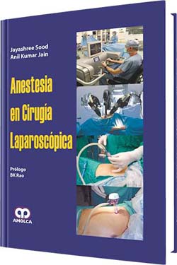 Anestesia en Cirugía Laparoscópica