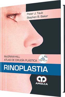 McGraw-Hill Atlas de Cirugía Plástica Rinoplastia