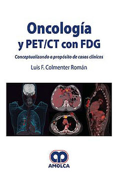 Oncología y PET/CT con FDG