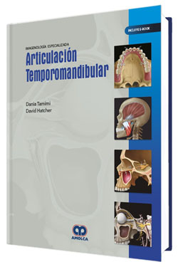 Articulación Temporomandibular 