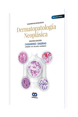 Dermatopatología Neoplásica