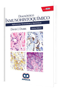 Diagnóstico Inmunohistoquímico