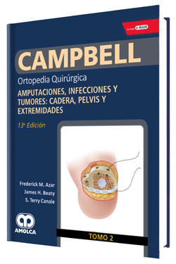 Campbell Ortopedia Quirúrgica T 2