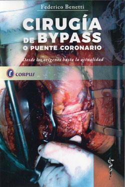Cirugía de Bypass o Puente Coronario
