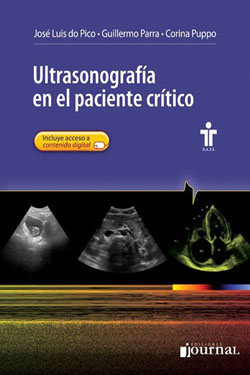 AGOTADO Ultrasonografía en el Paciente Crítico