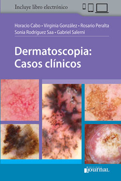 Dermatoscopia Casos Clínicos