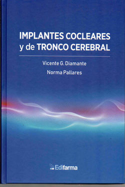 Implantes Cocleares y de Tronco Cerebral