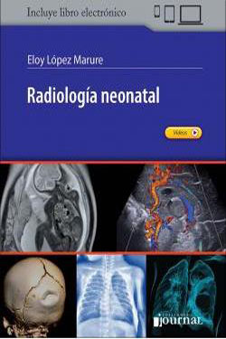 Radiología Neonatal
