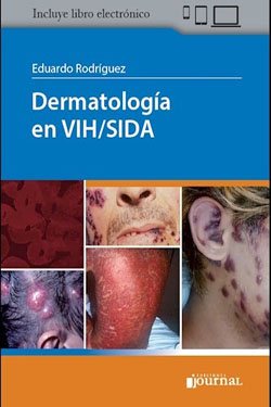 Dermatología en VIH / SIDA 