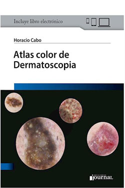 Atlas Color de Dermatoscopia