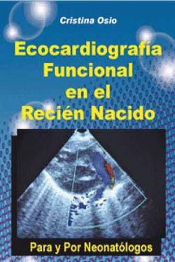 Ecocardiografía funcional en el recién nacido