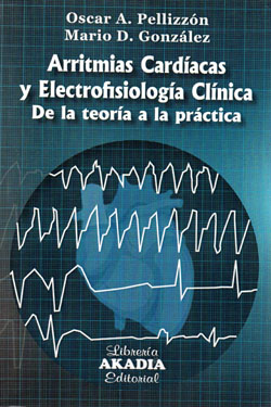 Arritmias Cardíacas y Electrofisiología Clínica