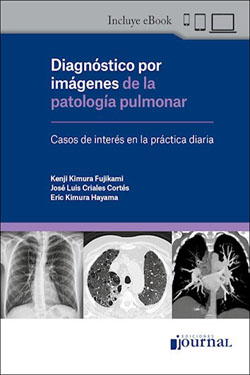 Diagnóstico por Imágenes de la Patología Pulmonar