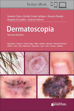 Dermatoscopia